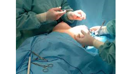 Profesionální plastika břicha, liposukce i operace prsou v epidurální anestezii