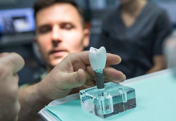 Zubní implantáty Praha