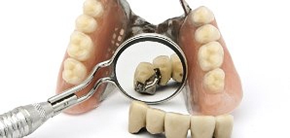 Zubní laboratoř, Praha 2, zhotovení zubních náhrad, implantátů, můstků, korunek