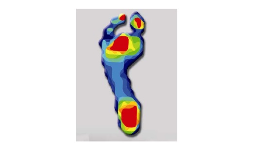 Analýza chůze - bolest chodidel Opava