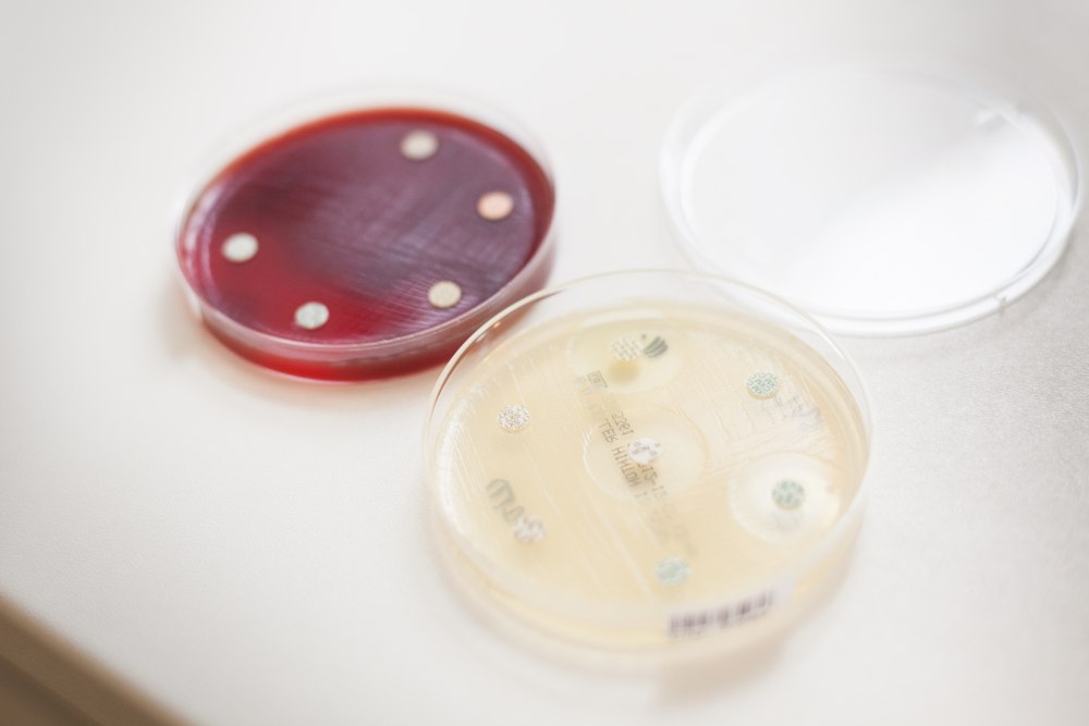 Hematologická a mikrobiologická vyšetření