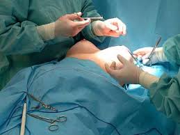 Plastická operace prsou Třinec