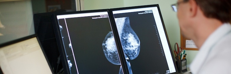 Screeningové mamografické vyšetření