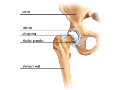Ortopedie, operace kolene, kyčle