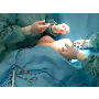 Plastická operace prsou a modelace poprsí - privátní plastická chirurgie