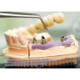 implantologie Praha 4 - zubní implantáty pro plnohodnotný život od značky Straumann a Camlog