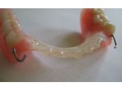 Výroba zubních snímacích náhrad Polná, výroba a opravy fixních i snímacích zubních náhrad