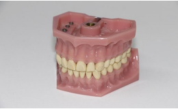Stomatologická laboratoř Polná - výroba zubních protéz