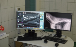 počítačová tomografie, operace