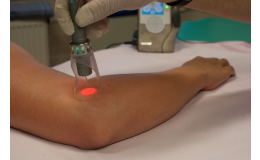 MLS Laser Therapy je novinkou v oblasti fototerapie.