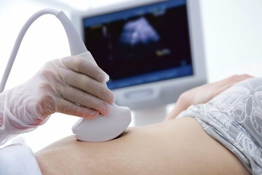 Screening těhotných žen, prenatální diagnostika