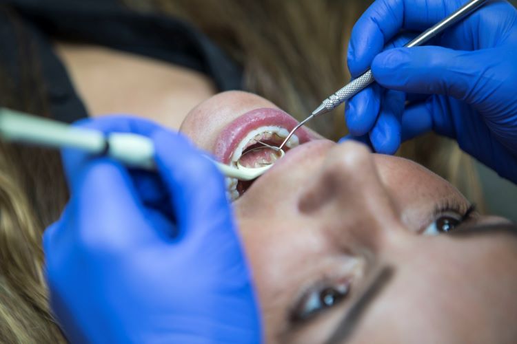 Léčba parodontitidy na stomatologické klinice v Praze