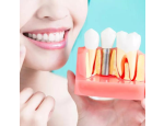Komfortní dentální péče na zubní klinice ve Zlíně, přirozené zubní implantáty