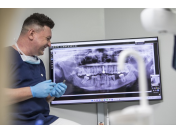 Ordinační bělení zubů na klinice v Praze 4