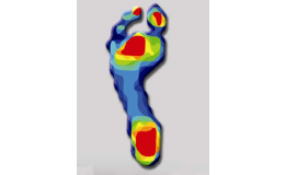 Analýza chůze – důležitá při řešení bolesti chodidel